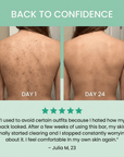Nero & Rocco™ Clarifying Body Bar – Clear Back Acne Without Irritation