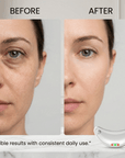 LumaLift™ Red Light Eye Sculptor- Depuff, Firm & Brighten Fast