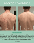 Nero & Rocco™ Clarifying Body Bar – Clear Back Acne Without Irritation