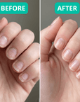 Nailora™ Botanical Nail Serum – Repair Weak Brittle Nails in 3 Days