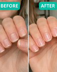 Nailora™ Botanical Nail Serum – Repair Weak Brittle Nails in 3 Days