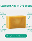 Nero & Rocco™ Clarifying Body Bar – Clear Back Acne Without Irritation