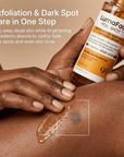 LumaFade™ Dark Spot Peel Serum – Exfoliates Dead Skin & Fade Dark Spots Fast