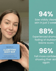 Nero & Rocco™ Clarifying Body Bar – Clear Back Acne Without Irritation