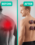 PulseLift™ Smart Heated Cupper – Fast Recovery Anywhere